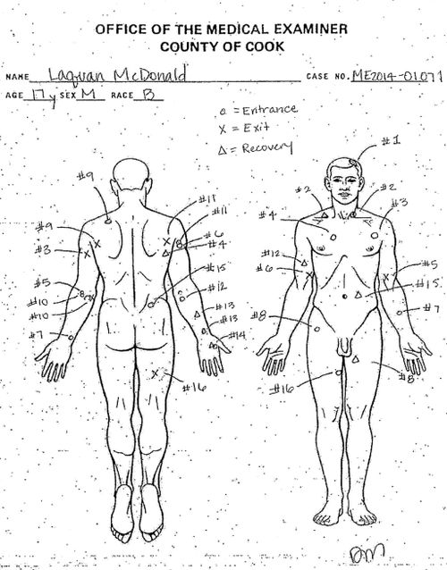 A diagram of bullet holes allegedly suffered by 17 year-old Laquan McDonald. (AAP)