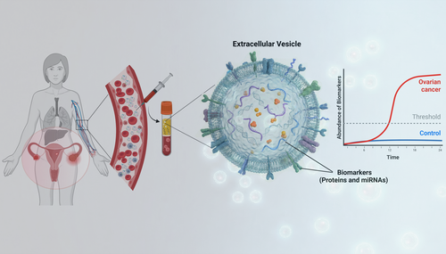 ovarian cancer screening test