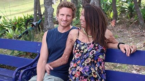 Turia Pitt with fiance Michael Hoskin. (Instagram)