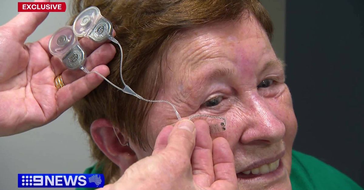 Bionic eye trial restoring ‘sense of light’ to small group of Aussies