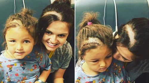 Woman shaves head in solidarity with daughter who underwent brain surgery