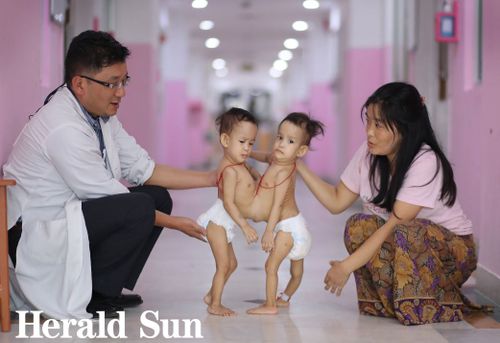 The two girls have spent their entire lives barely able to move, trapped staring at each other.

