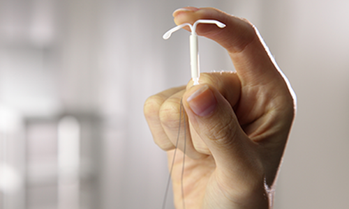 A Mirena device is a hormone-releasing intrauterine device (IUD).