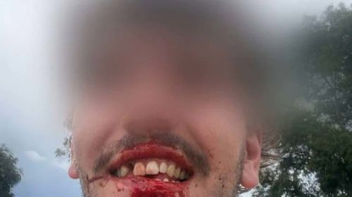 Un commerciante ha raccontato il momento in cui è stato brutalmente aggredito dopo che si era intensificata una discussione con un altro conducente. 