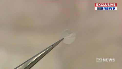 The reprogrammed stem cells are loaded onto the patch before being placed onto damaged tissue to stimulate blood flow. (9NEWS)