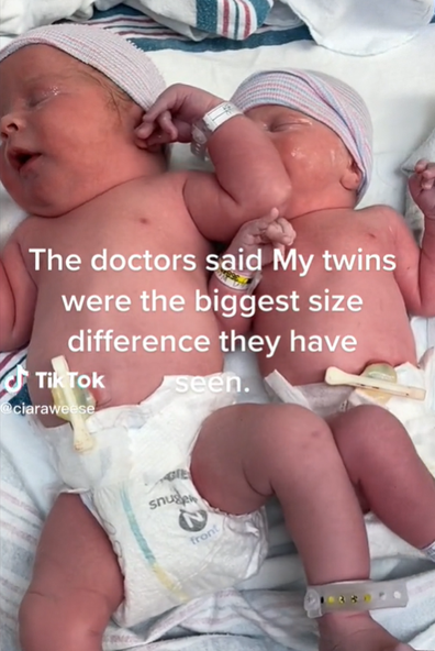 twins born with key size difference TikTok