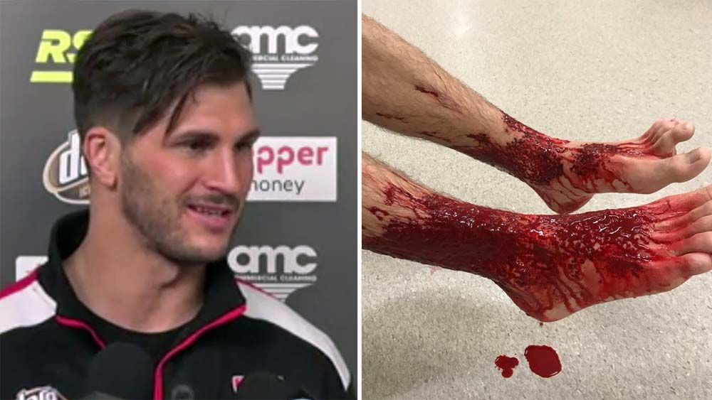 St Kilda players warned off Melbourne beach after sea lice attack on teenager