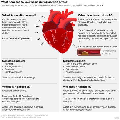 Heart attack information graphic 