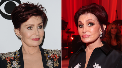 Sharon Osbourne discusses horrifying facelift: 'I looked like a Cyclops'