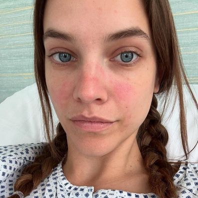 Barbara Palvin endometriosis: Supermodel opens up about years-long health battle