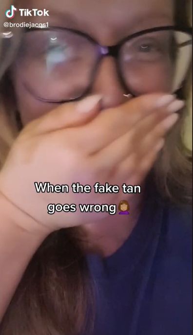 Woman shocked after fake tan turns her skin blue