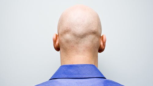 bald man