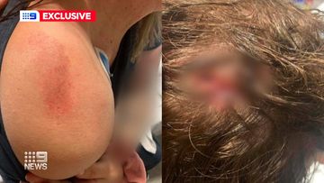 A young mother says she has been left traumatised after being flung from her moving car during a violent carjacking in Queensland.Kayla Barry jumped into the driver&#x27;s side window of her car to try and stop the thief during at a service station in Dinmore, Ipswich, west of Brisbane.