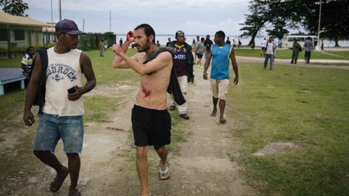 Refugees allegedly beaten with iron bar on Manus Island 