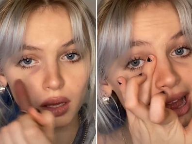 Viral TikTok makeup trend claims eye bags are in