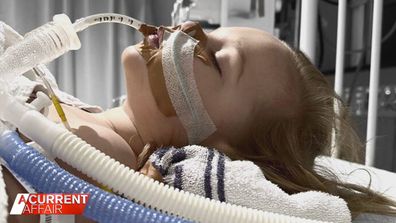 Some of Skyler Coghlan's seizures have been so intense she's been intubated in the ICU.