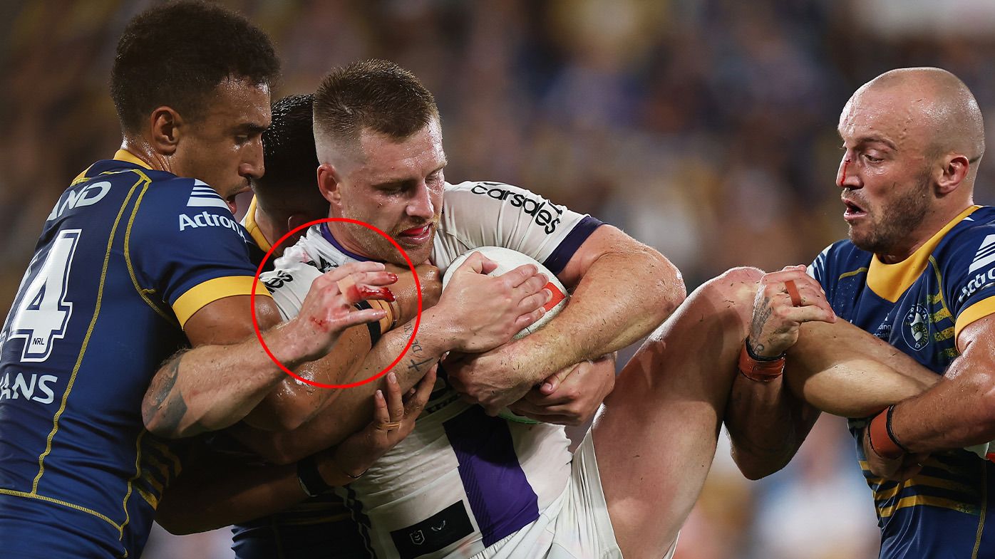 Round two NRL teams analysis: Melbourne Storm reveal replacement for injured Cameron Munster