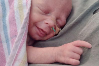 Baby Opal was born nine weeks premature in the back of an ambulance at Wagga Base Hospital.