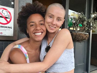 Rachael lost her hair while going through cancer treatment.