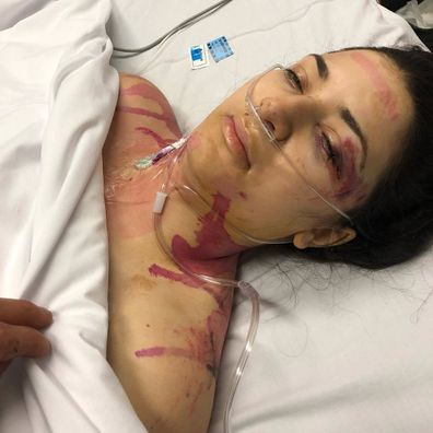 Christina Vithoulkas spent three days in ICU after the accident.