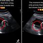 Unborn baby's ultrasound performance takes parents by surprise