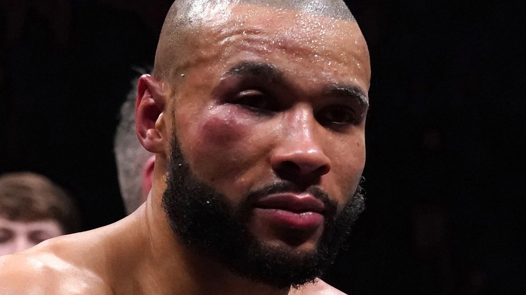 Chris Eubank Jr with an injury to his right cheek following defeat to Liam Smith in the middleweight bout at the AO Arena, Manchester. Picture date: Saturday January 21, 2023. (Photo by Nick Potts/PA Images via Getty Images)