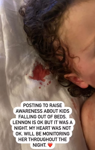 Tammin Sursok shares shocking photo of daughter Lennon's bloody gash after falling off the bed.