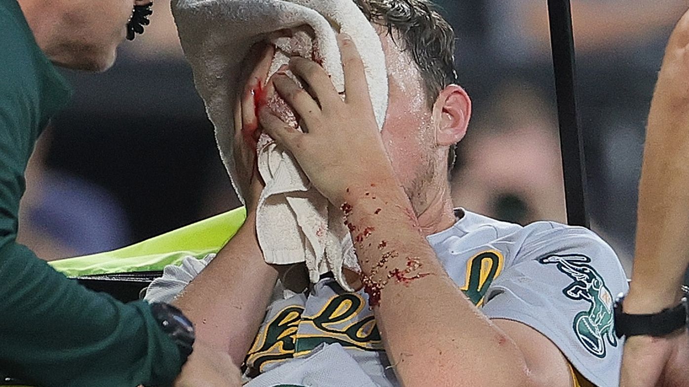 Chris Bassitt of the Oakland Athletics leaves the field after he was hit in the face by a line drive off the bat of Brian Goodwin of the Chicago White Sox.