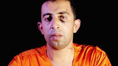Lieutenant Muath al-Kaseasbeh appeared to have abused in captivity prior to his execution. 