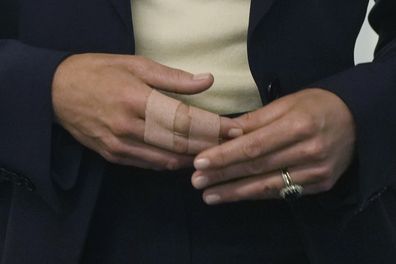 Kate, the Princess of Wales, with a finger splint during her visit to HMP High Down in Surrey to learn about how the charity is supporting those in the criminal justice system to manage and recover from their addictions. in London, England, Tuesday, Sept. 12, 2023. (AP Photo/Kin Cheung, Pool)