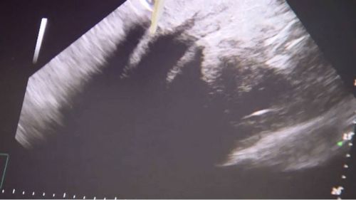An ultrasound of Num-Oi's calf. (9NEWS)