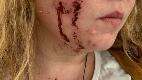Dog bites woman on face as she tries to save cat from attack