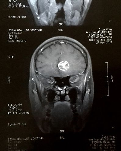 MRI