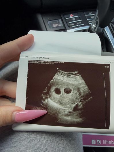 Veruca Salt pregnant with twins 