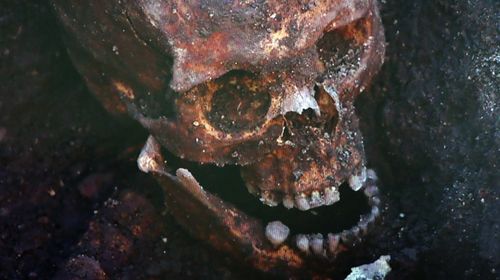 The skull of Richard III found in Leicester.