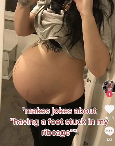 Bethany Love shares photo of baby's misshapen feet that were stuck under her rib cage