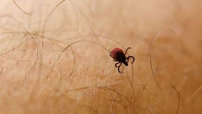 As ticks are very small and their bites do not usually hurt, ticks can easily be overlooked on the body.
