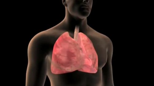 Lung cancer is Australia's worst cancer killer. (9NEWS)