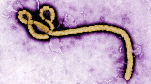 An Ebola virus virion. (AAP)