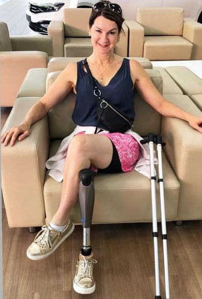 Anne cancer amputee Chris O'Brien Lifehouse 