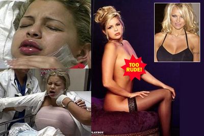 Sha Ross had breast implants, lip implants and liposuction under her chin to look more like her idol Pamela Anderson. The freaky results won her a spot in <i>Playboy</i> magazine, but according to <i>The Sun</i>, Pamela Anderson herself finds Ross's fascination "creepy."