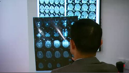 While a possible complication of the drug, found in just one patient in each drug group, was the possibility of brain haemorrhaging - doctors are still supporting the drug. Picture: 9NEWS.