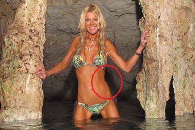 Looks like skinny isn't skinny enough for Tara Reid, who shocked followers with these bizarre bikini snaps in Mexico last week. <br/><br/>Perhaps she should've smoothed out that jagged edge she's trying to pass off as a hip bone?