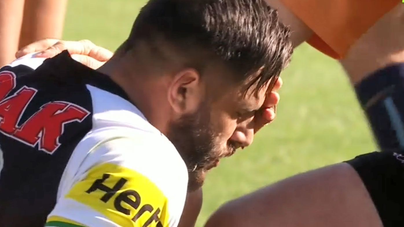 Josh Mansour fractures his face in 2018. 