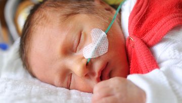 An Australian hospital is touting a new trial aimed at treating premature babies with lung problems using placenta cells a success. Picture: iStock Photo