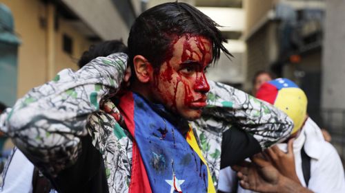 A bloodied protester after street demonstrations in Caracas.