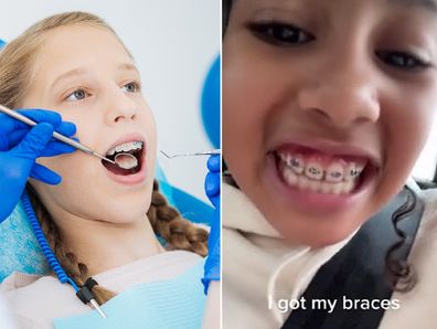 North West proudly showed off her braces in a TikTok video. 