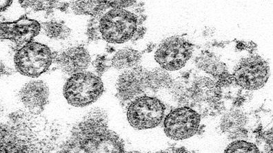 Spherical coronavirus particles from the first US case of COVID-19.