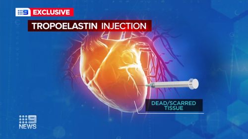 Scientists say new injection could heal long term damage from heart attacks, reducing the number of deaths for heart related diseases 