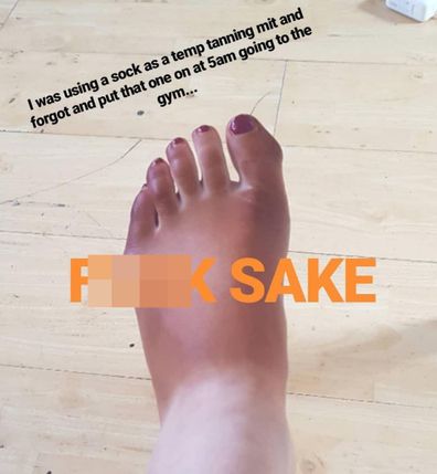 This woman used a sock to apply tan and accidentally wore it to the gym, leaving one foot extra dark.